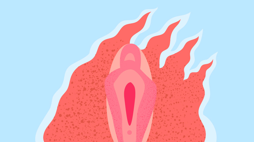 Treatment for Vaginal Dryness: Where to Start.