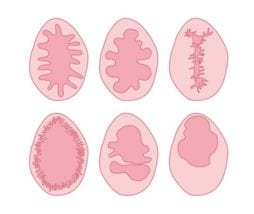 vaginal corona hymen diagram RFSU