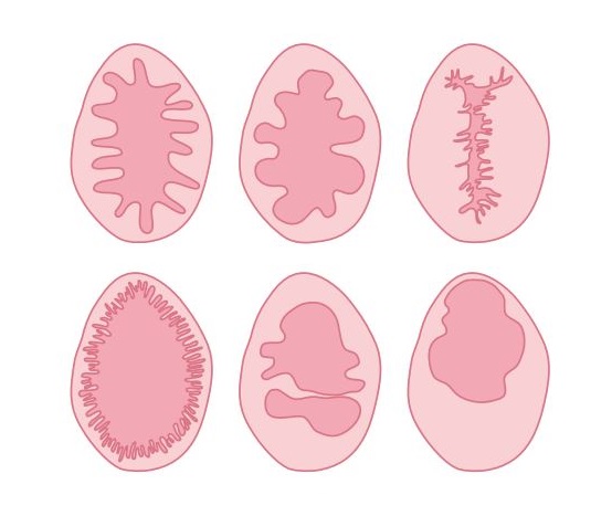 Hymen diagram RFSU