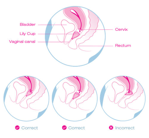 Leaky shop menstrual cup