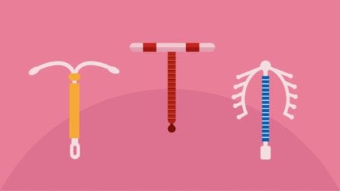 All Your IUD Questions Answered
