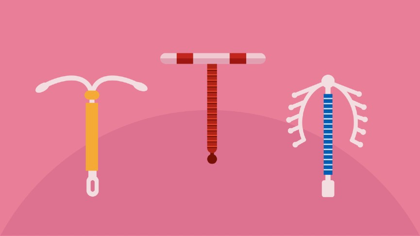 The length of your iud string feels shorter or longer than it was you can f...