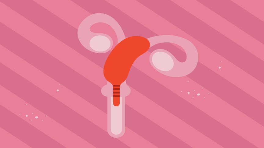 How to Use a Menstrual Cup with a Tilted Uterus: Riding the Tilt-a-Whirl