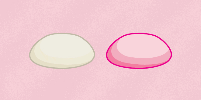 what is breast implant illness