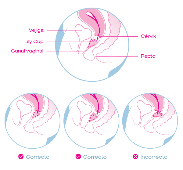 Cómo colocar la copa menstrual