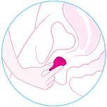 sacar_copa_menstrual_atascada