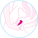 sacar_copa_menstrual_atascada